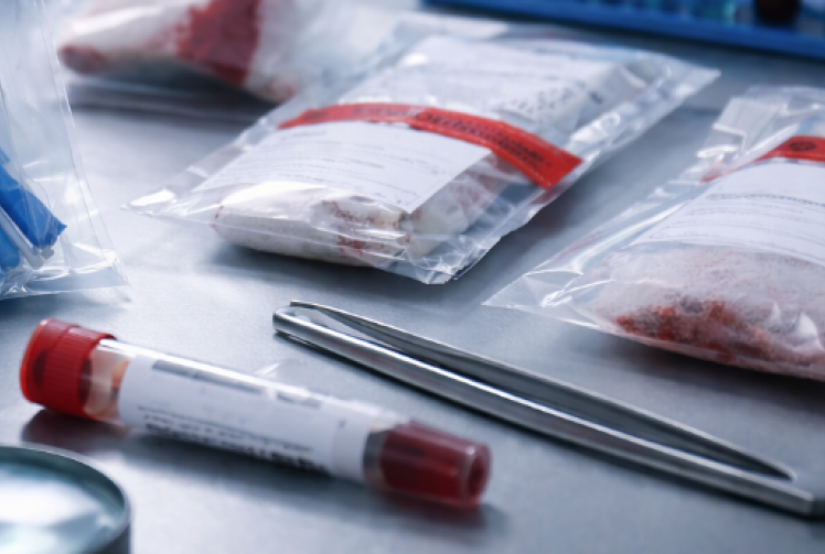 Archive picture of 'evidence' or forensics.